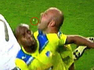 soccer-player-got-his-teeth-knocked-out-while-trying-to-take-the ...
