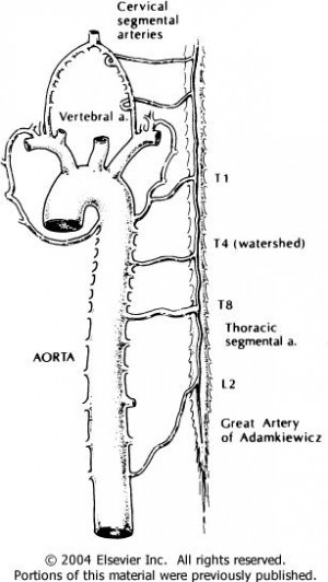 Anterior Cord Syndrome Vertebral Artery Radicular Arterial Branches