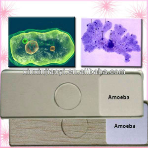 Amoeba proteus Amoeba W M Prepared slides jpg
