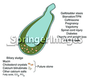 Gallbladder stasis, sludge, and stone formation