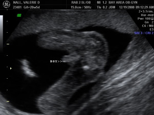 Boy Ultrasound Photos