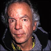 ... Future: The accident left a dramatic scar on Spalding Gray's forehead
