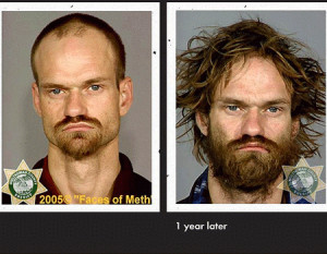Related Pictures meth addiction effects could cause for the brain