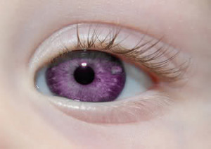 ... eyes exi st, makeup tips, purple eye disease, Elizabeth Taylor violet
