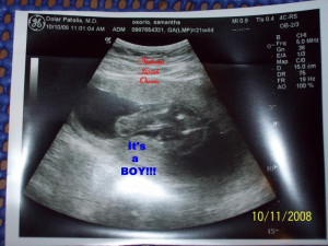 ultrasound ITS A BOY Image