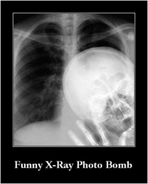 Funny X-Ray Photo Bomb Picture