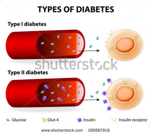 of-diabetes-type-and-type-diabetes-mellitus-insulin-dependent-diabetes ...