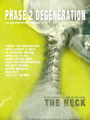 The 4 Phases of Degeneration Chiropractic Posters! Modern Color Theme!