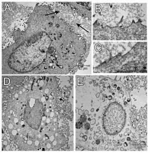 Transmission Electron Microscope Cell