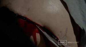 Lori dies during her emergency C-section.