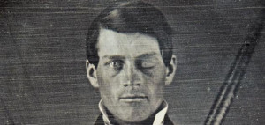... iron made Phineas Gage history's most famous brain-injury survivor