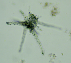 Amoeba Proteus Under Microscope