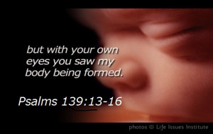 Sanctity of Life – Be Her Voice FOTF