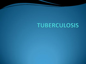 TUBERCULOSIS TUBERCULOSIS tuberculosis is on by mikeholy