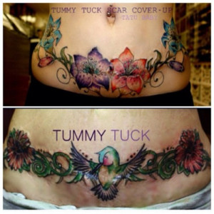 Tummy Tuck Scar Cover Up Tattoos Taken With Instagram picture