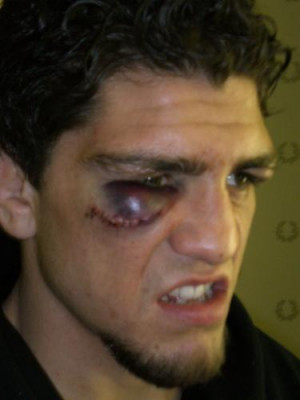 MMA Photo Tribute: 16 Seriously Messed-Up Eyes [UPDATED]