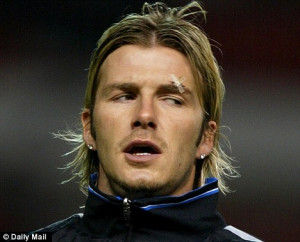 Pain game: Ferguson infamously split David Beckham's head by kicking a ...