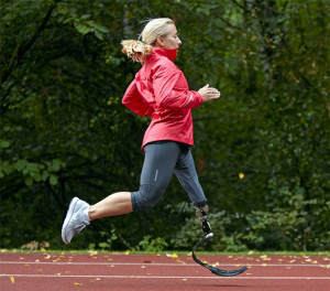 Prosthetic leg. Sarah!