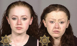 effects of using meth kiss that yummie dirty meth mouth