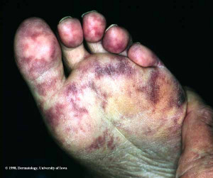 Education Clinical Disease Images