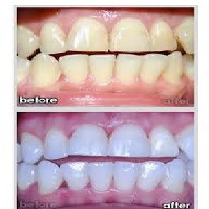 beauty, whiten your teeth, teeth whitening products
