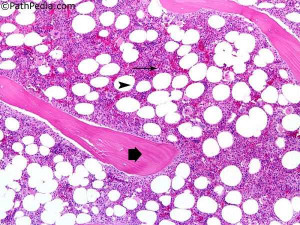 Normal Bone Marrow Histology
