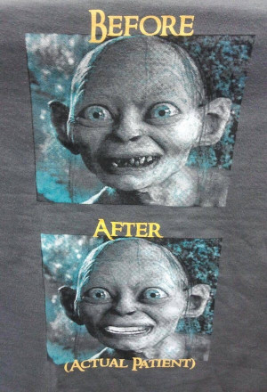 Gollum, before and after. You know what the after picrure reminded me ...