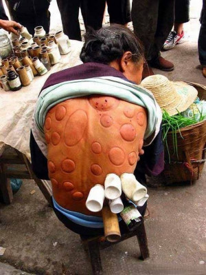Chinese Traditional Medicine (7 pics)