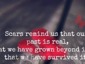 scars quotes photo: Scars remind us the past is real we survived it ...