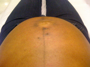 Joslynne Hood Ohyesshemodels Away Stretch Marks