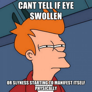 Cant Tell If Eye Swollen Or Slyness Starting To Manifest Itself ...