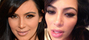 Kim Kardashian Plastic Surgery: Pregnant Star Debuts Plump New Lips ...