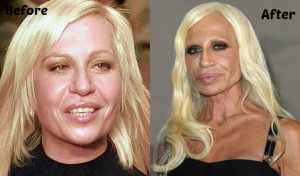 15 Celeb Plastic Surgery Operations Gone Horribly Wrong!