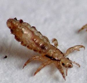 Video How Treat Head Lice Ehow