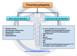 Thrombocytopenia-Differential-diagnosis-Medical-Institution.png