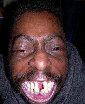 Black People with Big Teeth