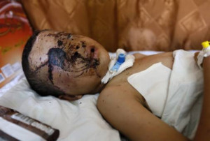 ... gaza-kid-to-see-this-world-again-4Please help us.Please share this