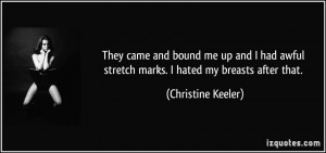 They came and bound me up and I had awful stretch marks. I hated my ...