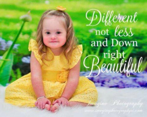 Down syndrome- I think this may be my favorite quote! It's perfect! I ...