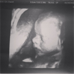 Leave a Reply Cancel reply