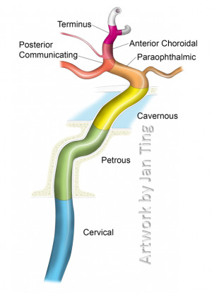 Internal Carotid Artery Segments