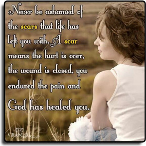 Never be ashamed of the scars life had left you with....
