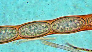 Fig 1 Note the small oil drops fill the entire spore of S austriaca