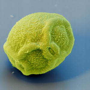 Pollen under a microscope