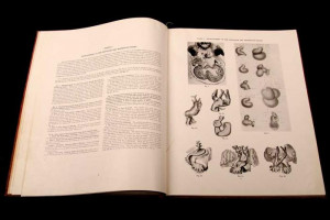 Atlas of Congenital Cardiac Disease, by Dr. Maude E. Abbott - 1936 ...