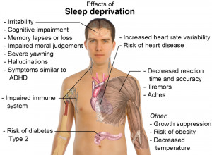 Effects of sleep deprivation (from Wikimedia Commons )