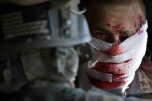 Sgt. Shane Hanley U.S.M.C. severely wounded in combat in Afghanistan.