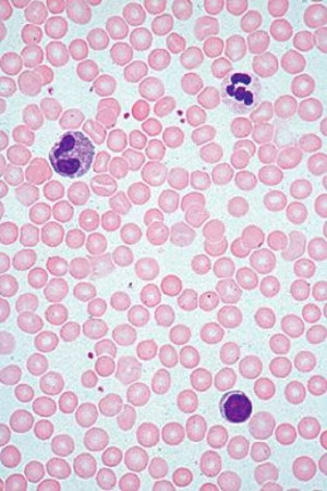 human blood smear under microscope