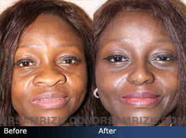 RE: Places with Surprisingly Ugly Girls