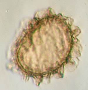 Moss Sporophyte Under Microscope
